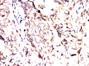 PAK1 Antibody