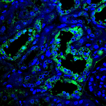 PAK1 Antibody