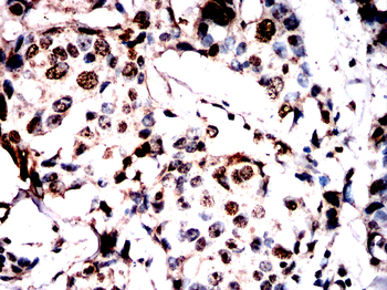 ANP32A Antibody