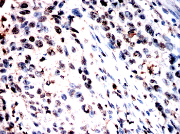 ANP32A Antibody