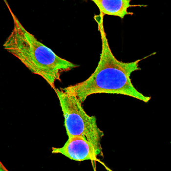 USP9X Antibody