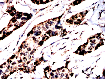 FKBP4 Antibody