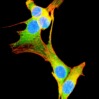 TFPI2 Antibody