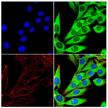GSDME Antibody