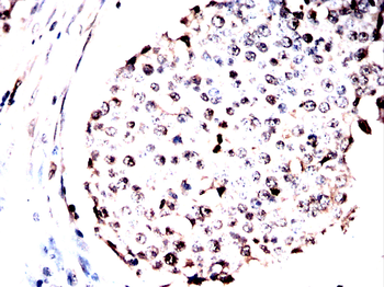 CDT1 Antibody