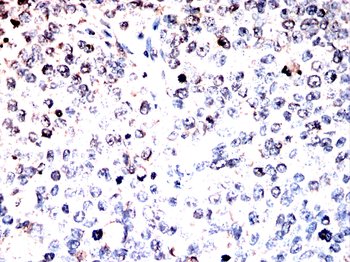 STK4 Antibody