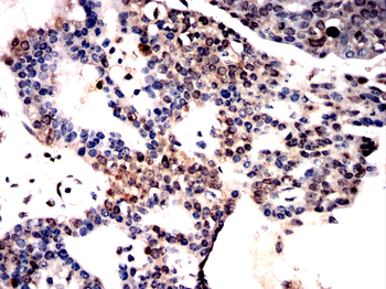 STK4 Antibody