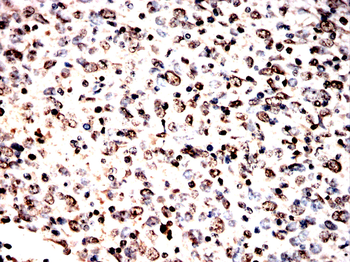 VCP Antibody