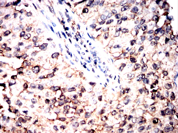 CFL1 Antibody