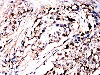 CFL1 Antibody