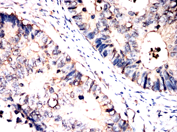 CFL1 Antibody