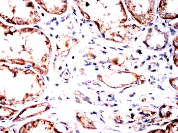 ABL1 Antibody
