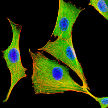 ABL1 Antibody