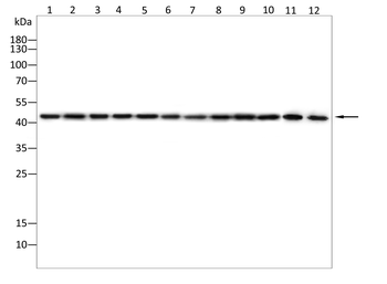 IL-11RA Rabbit Polyclonal Antibody