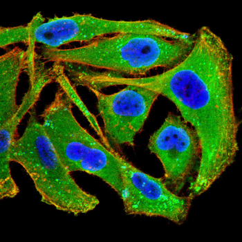 IL-11RA Rabbit Polyclonal Antibody