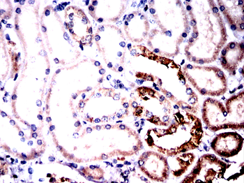 CAND1 Antibody