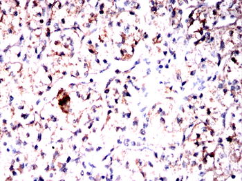 CAND1 Antibody