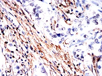 POSTN Antibody