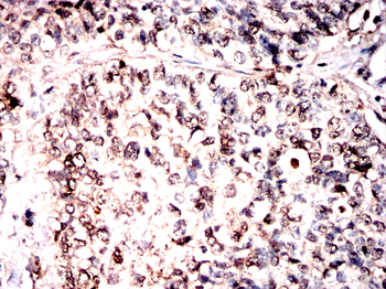 PPP3CA Antibody