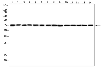 Alpha 2 Antiplasmin Rabbit Polyclonal Antibody