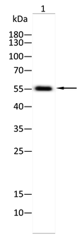 Alpha 2 Antiplasmin Rabbit Polyclonal Antibody