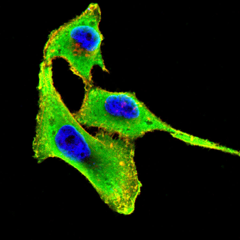 Alpha 2 Antiplasmin Rabbit Polyclonal Antibody