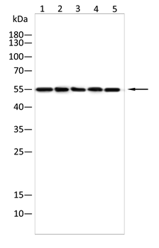 Alpha 2 Antiplasmin Rabbit Polyclonal Antibody