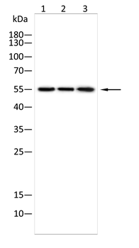 Alpha 2 Antiplasmin Rabbit Polyclonal Antibody