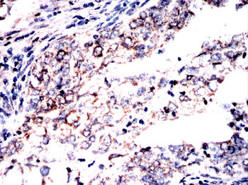 MT-CYB Antibody
