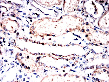 MT-CYB Antibody