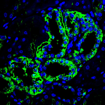 MT-CYB Antibody