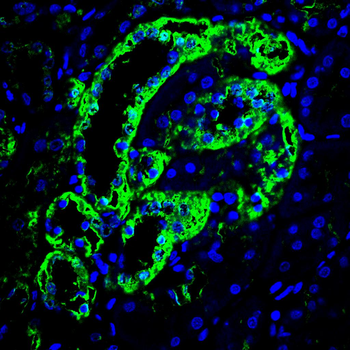 MT-CYB Antibody