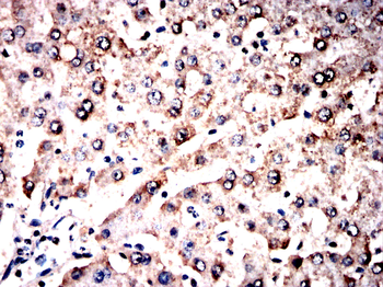 MT-CYB Antibody