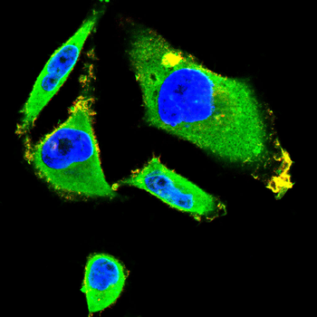 MT-CYB Antibody