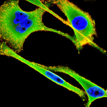 Vasopressin Rabbit Polyclonal Antibody
