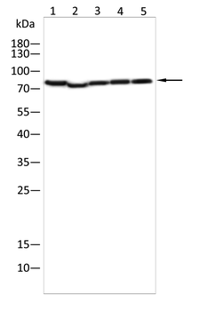 ACSL4 Rabbit Polyclonal Antibody