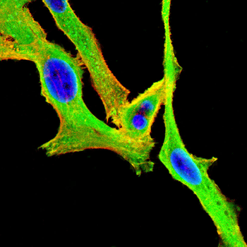 ACSL4 Rabbit Polyclonal Antibody