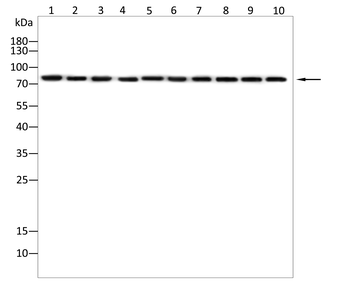 ACSL4 Rabbit Polyclonal Antibody