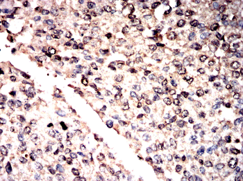 CTSL/CTSV/CTSK/CTSH Antibody
