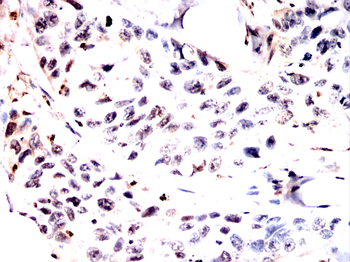 POLB Antibody