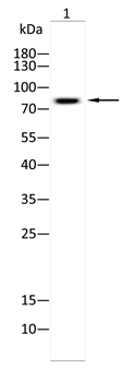 ABCD1 Antibody