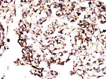 NDUFS4 Antibody