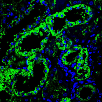 NDUFS4 Antibody