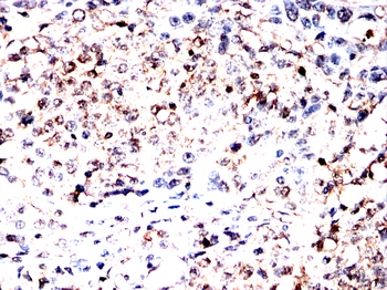 NDUFS4 Antibody