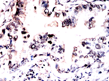 TAF15 Antibody