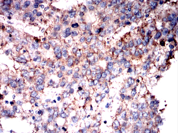 RAP1A/RAP1B Antibody