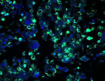 LYPLA1 Antibody