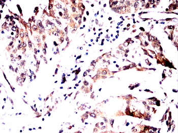 LYPLA1 Antibody