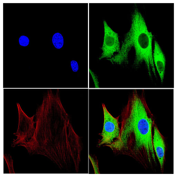 LYPLA1 Antibody