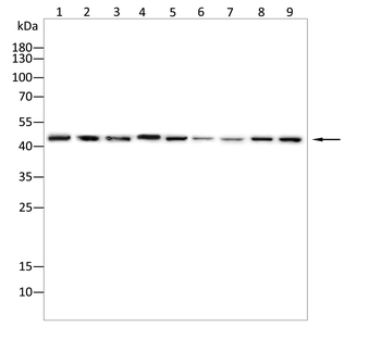 ACP3 Antibody